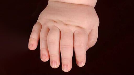 Hand